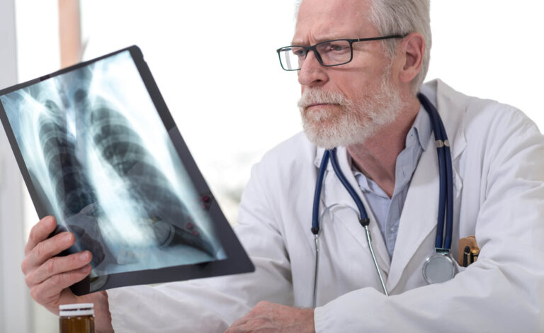 Radiologists still do better job of diagnosing lung diseases than artificial intelligence