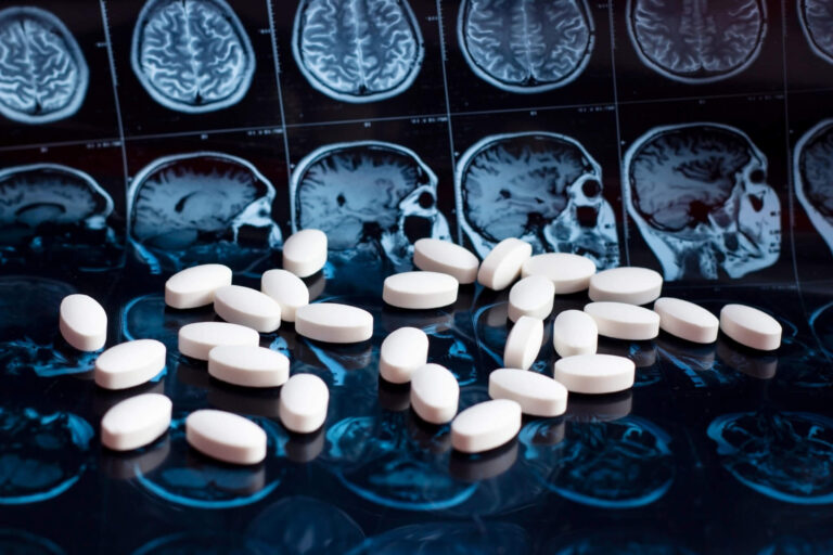 Less than 10% of Alzheimer’s patients eligible for new antibody treatments