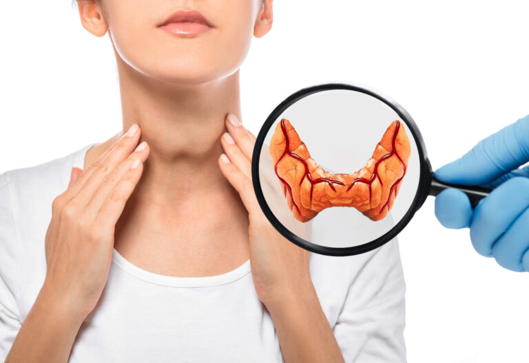 3 Things Hypothyroidism Patients Should Eat – And 4 That Could Cause Issues