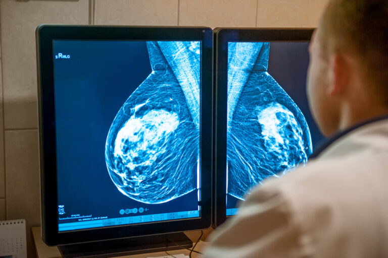 Breakthrough Exposes Potential Weak Spot In Triple-Negative Breast Cancer