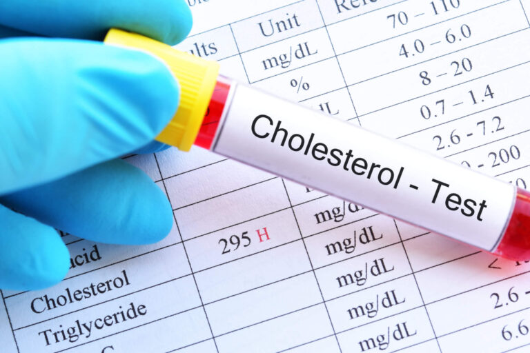 Too Much ‘Good’ Cholesterol Linked To Higher Dementia Risk