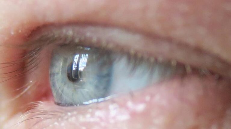 Tiny eye implant could revolutionize diabetes treatment