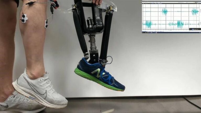 Robotic prosthetic ankle may restore ‘natural’ movement and stability among amputees